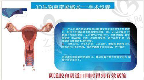 与其他医院对比优势