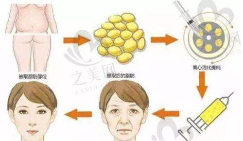 深圳整形价格