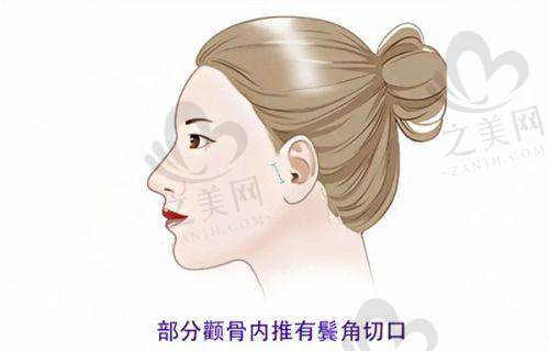 如何挑选靠谱的医美机构