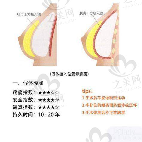 手术实例成效显著