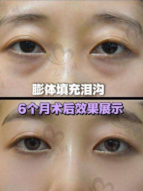 审美独特贴合需求