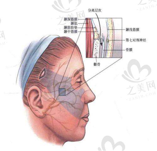 厦门皮肤科对痤疮治疗的关注