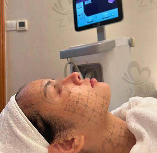 ONDA医美项目技术优势