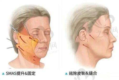 深圳真的超皮秒机构有哪些