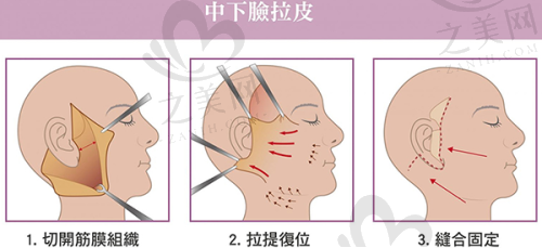 郑州皮肤科医生治疗皮肤过敏的方法
