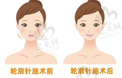 广州综合医院皮肤科排名信息