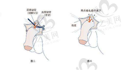 郑州皮肤科治疗后的护理注意事项