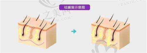 深圳口碑好的皮肤科医生推荐