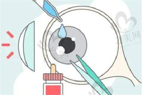 擅长手术:多种技术解决眼科问题