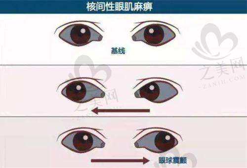 北京大学人民医院眼科——专精的眼科治疗机构