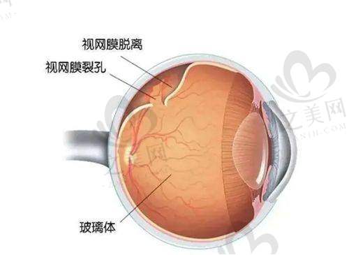 地区因素影响义眼价格
