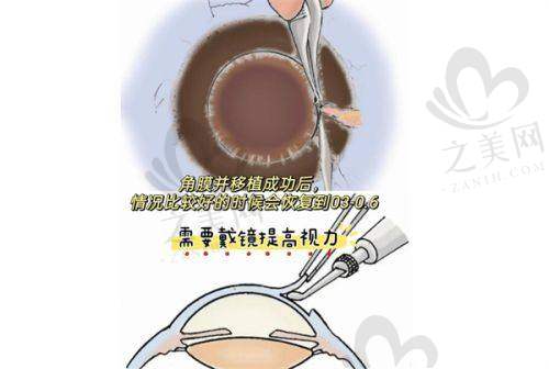 选择陈星医生的优势