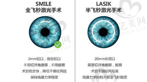 西安佰视佳眼科:个性服务显专精