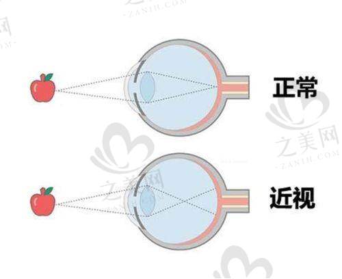 不同种类各有特点
