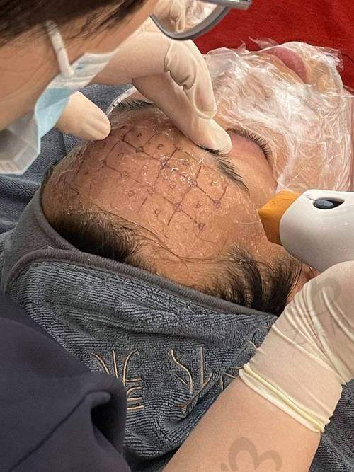 ONDA医美项目定义