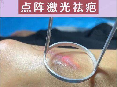 就诊建议的实用指南