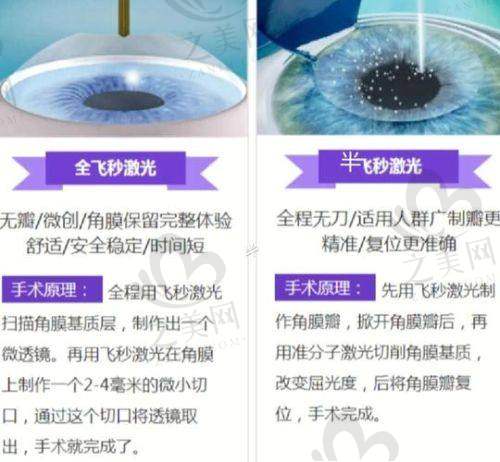 杭州飞秒手术其他可考虑的医院之杭州市第一人民医院眼科