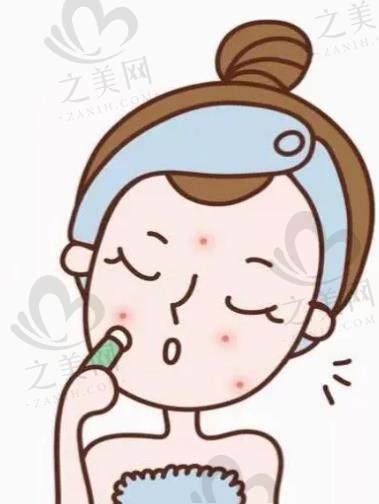 郑州皮肤科医生擅长治痘、银屑病等病,王晓丽等口碑好,附坐诊信息及皮肤过敏疗法