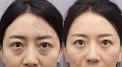 技术项目与收费是否合理