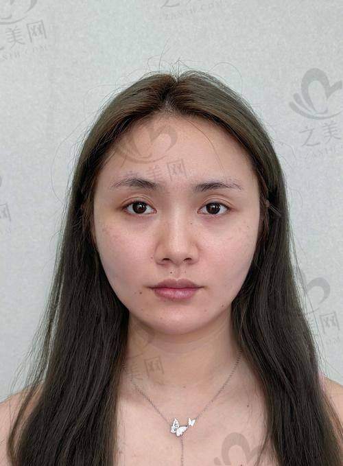海魅云境和濡白天使有什么不一样?成分、作用、适用部位、价格等差异全解析