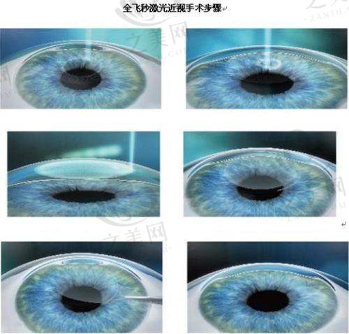 郑州华厦视光眼科医院正规性