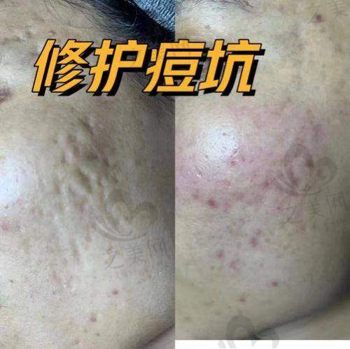西安高一生医疗美容医院优势