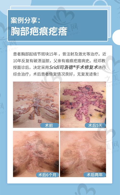 西安美莱医学美容医院实力