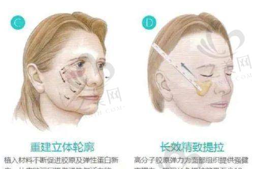 热门项目