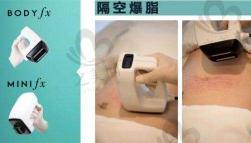 黄金微针项目介绍