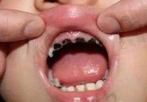 中山好民生口腔门诊部怎么样?顾客评价好收费合理,微创种牙、隐形正畸等特色项目别错过