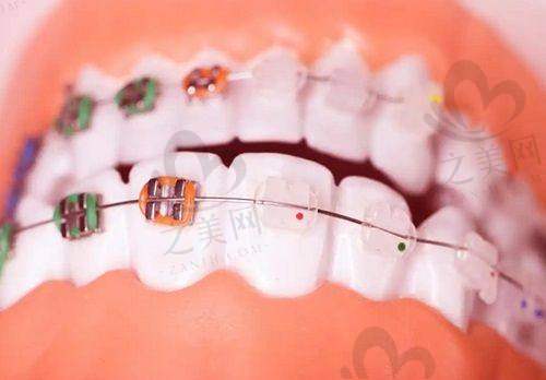 2025年楚雄口碑好的口腔医院大揭秘:浩瑞奥德、博德等优势、评价、收费全知晓