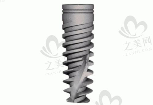 做种植牙后后悔出现的常见问题