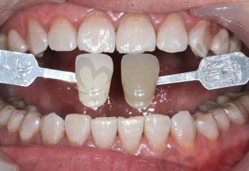 2025年楚雄好口碑口腔医院的医生团队介绍