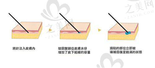 实际实例展现成效