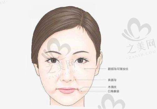苏州美莱美容医院眼整形
