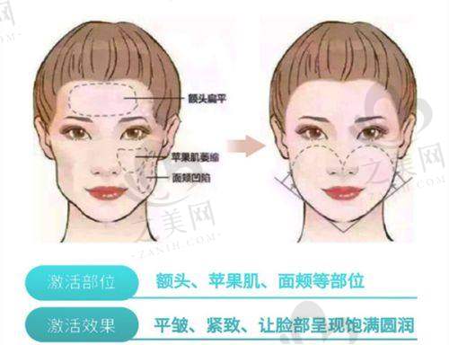 口碑实力