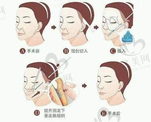 医生技术分析