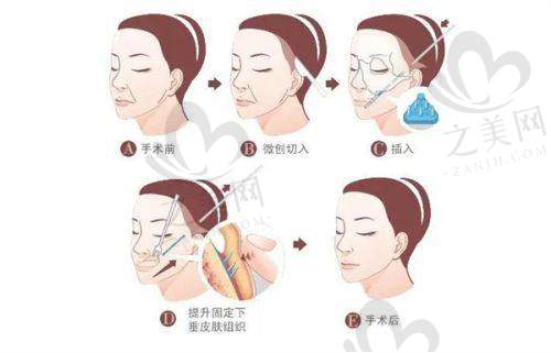 与其他医院的对比优势