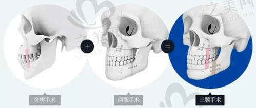 海南海口韩美整形医院预约挂号