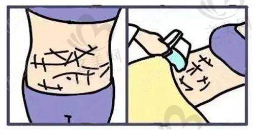 擅长项目