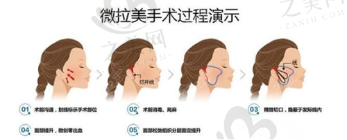 建议