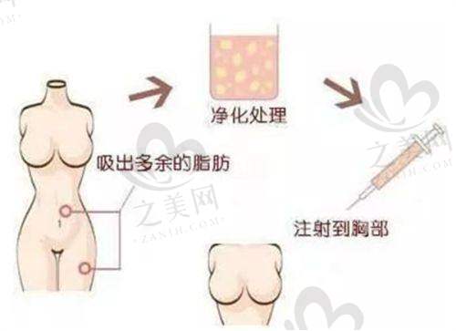 北京京民医院隆鼻、鼻综合、吸脂等项目咋样?医生技术好经验足,反馈不错