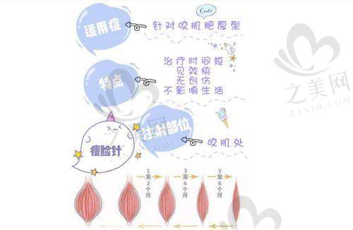重点整形项目
