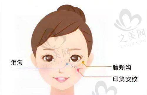 预约方式