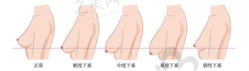 海南海口韩美整形医院正规吗？