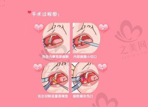 消费者评价与口碑