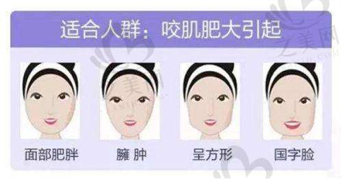 主打项目与医生团队