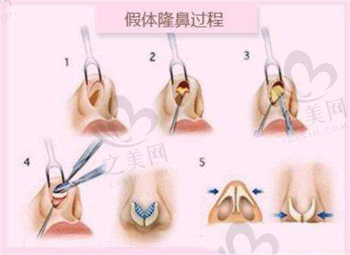 与其他医院对比