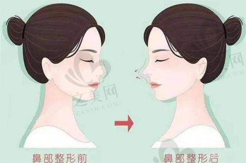 种牙项目优势
