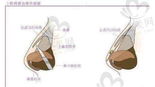 海南海口韩美整形医院价格